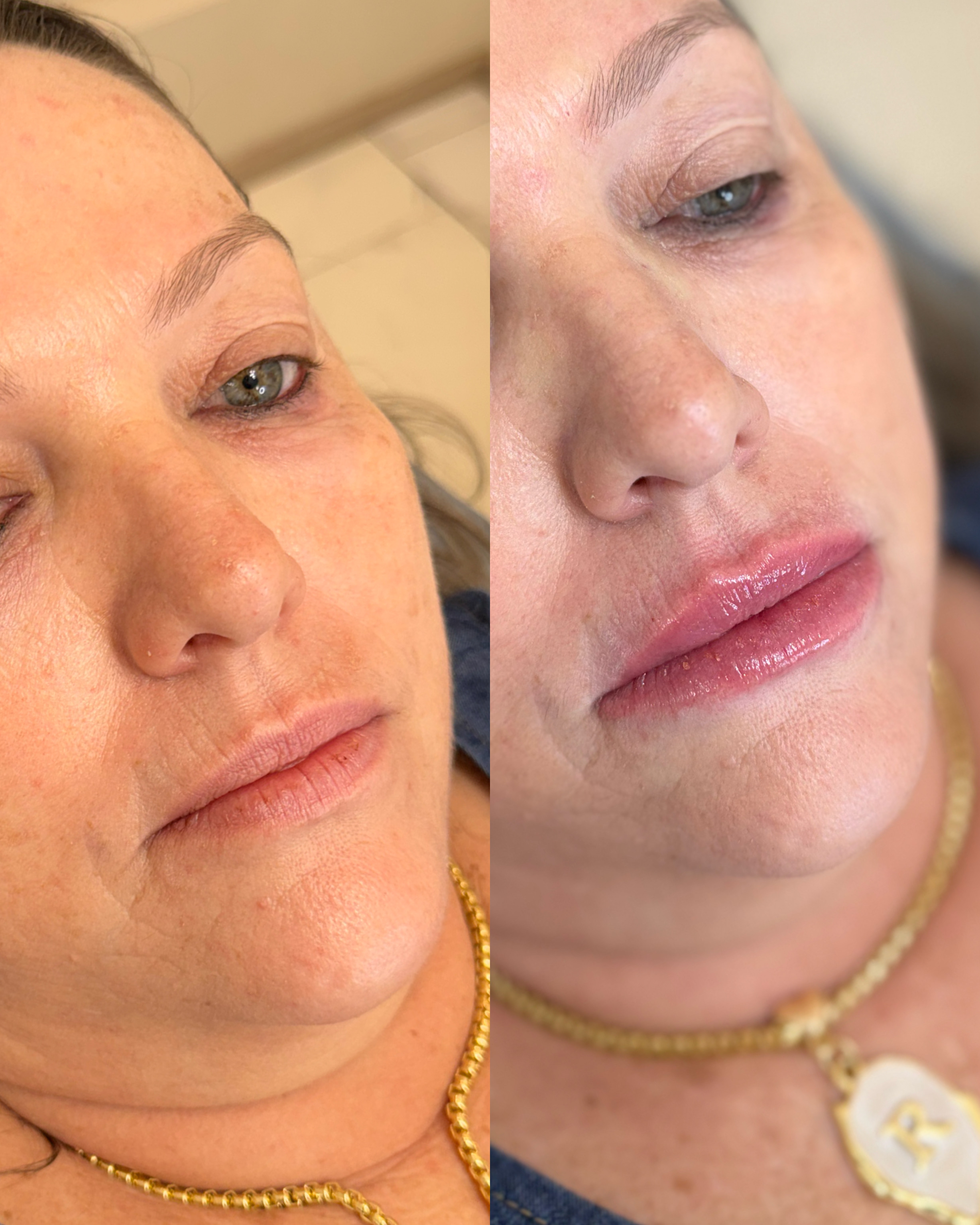 Avalia&ccedil;&atilde;o facial